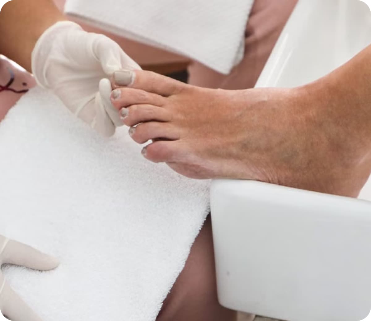 Gloved podiatrist treating a patient's toenail