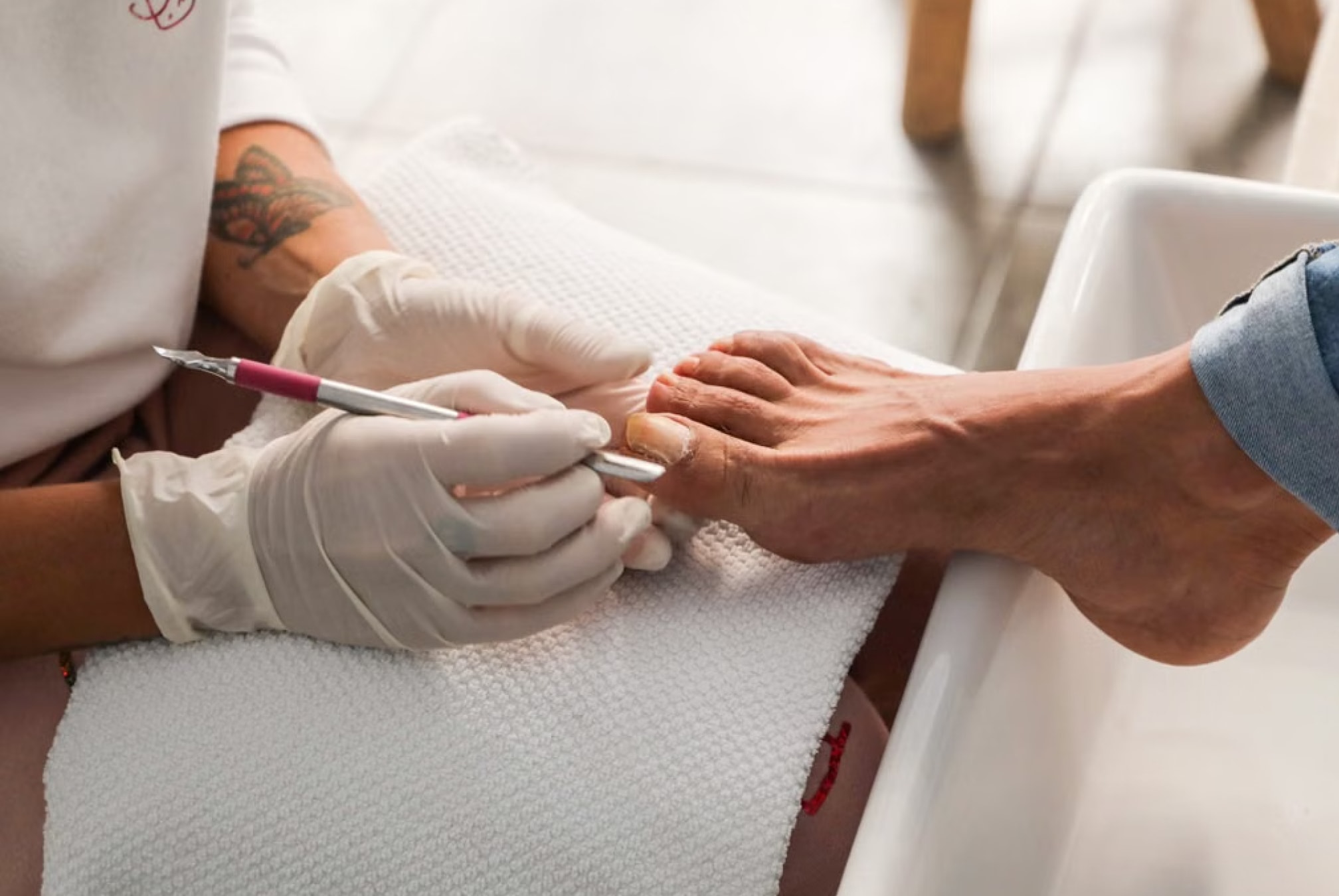 Podiatrist treating a verruca on the underside of a patient's foot