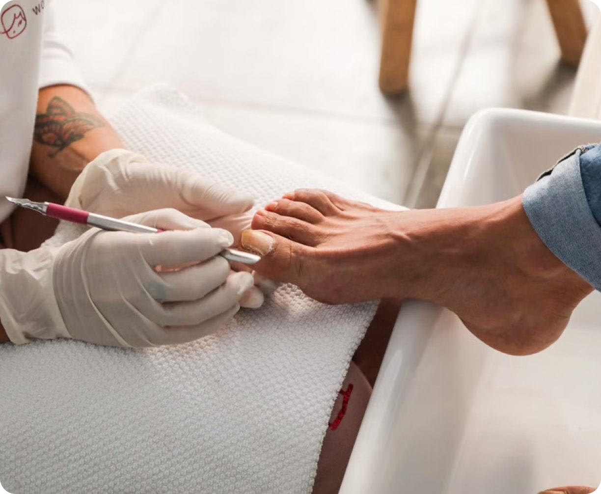 Gloved podiatrist filing a patient's toenail Gloved podiatrist filing a patient's toenail